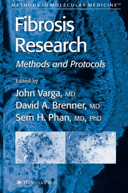 Book cover of: Fibrosis Research