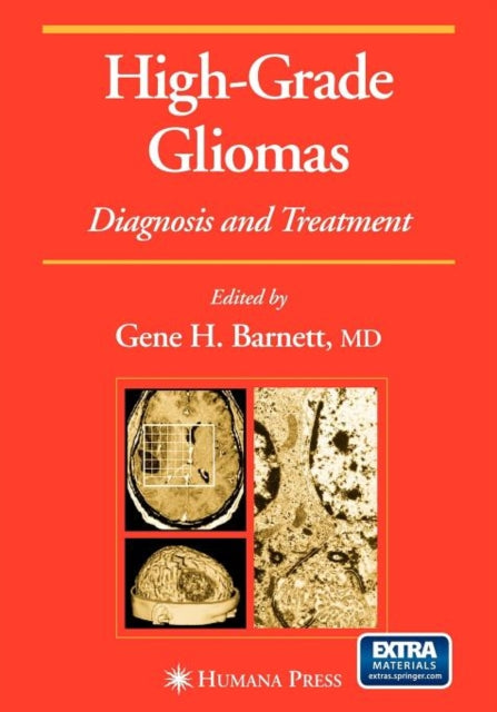 Book cover of: High-Grade Gliomas. By: Gene H. Barnett