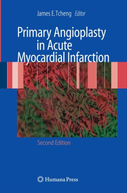 Book cover of: Primary Angioplasty in Acute Myocardial Infarction