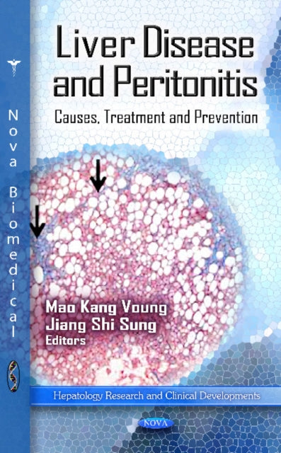 Book cover of: Liver Disease & Peritonitis. By: Mao Kang Voung