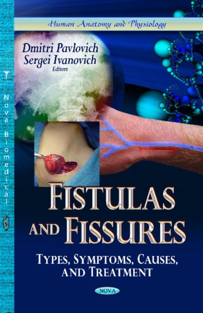 Book cover of: Fistulas & Fissures. By: Dmitri Pavlovich