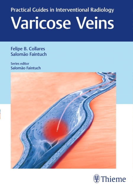 Book cover of: Varicose Veins. By: Felipe Collares