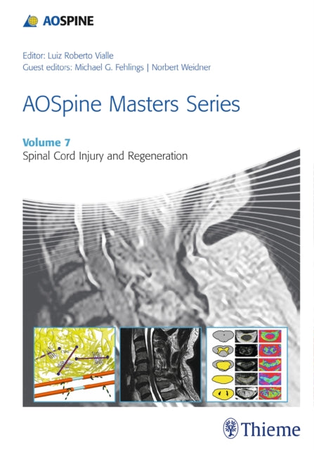 Book cover of: AOSpine Masters Series, Volume 7: Spinal Cord Injury and Regeneration. By: Michael Fehlings