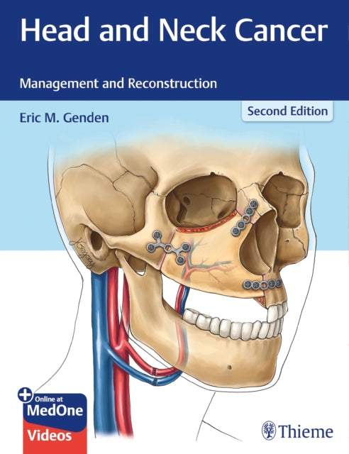 Book cover of: Head and Neck Cancer. By: Eric M. Genden
