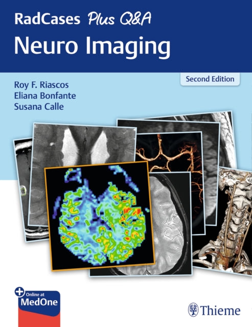 Book cover of: RadCases Plus Q&a Neuro Imaging