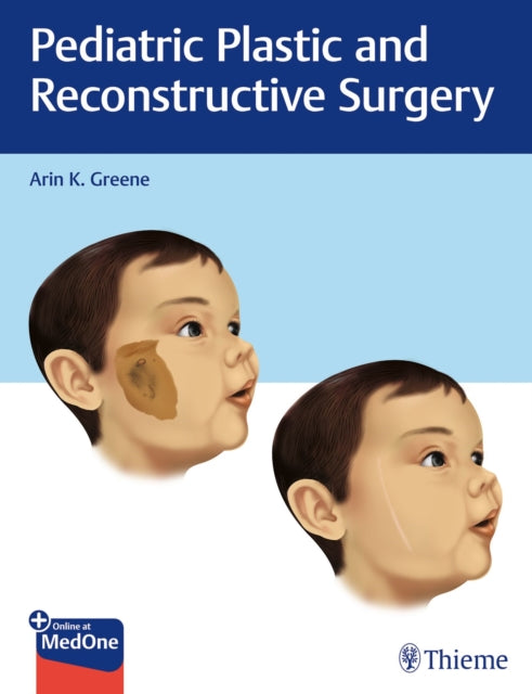 Book cover of: Pediatric Plastic and Reconstructive Surgery. By: Arin K. Greene