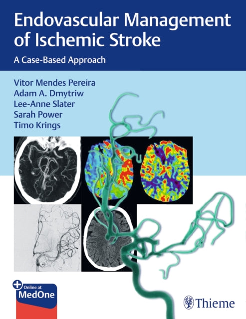 Book cover of: Endovascular Management of Ischemic Stroke. By: Vitor Pereira