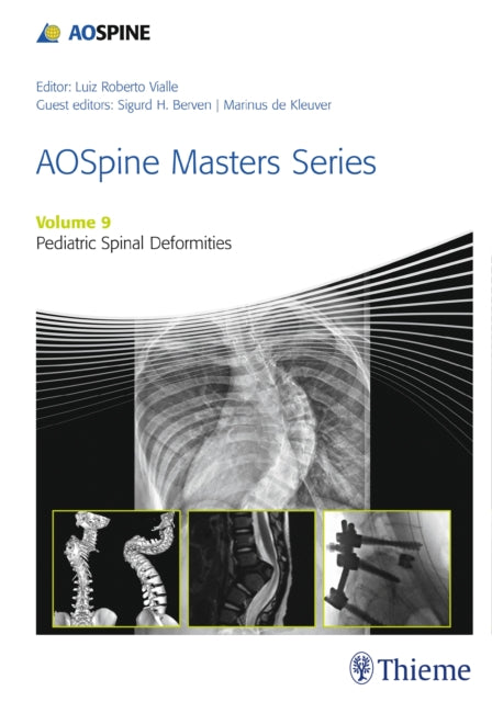 Book cover of: AOSpine Masters Series, Volume 9: Pediatric Spinal Deformities. By: Sigurd H. Berven