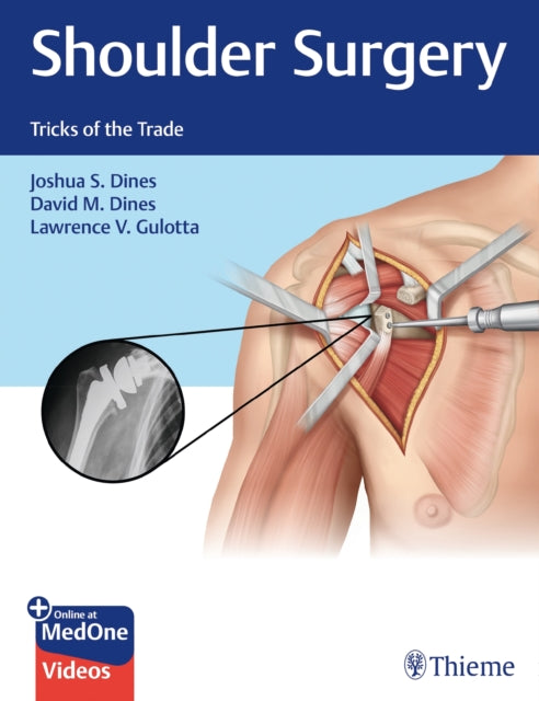 Book cover of: Shoulder Surgery. By: Joshua S. Dines