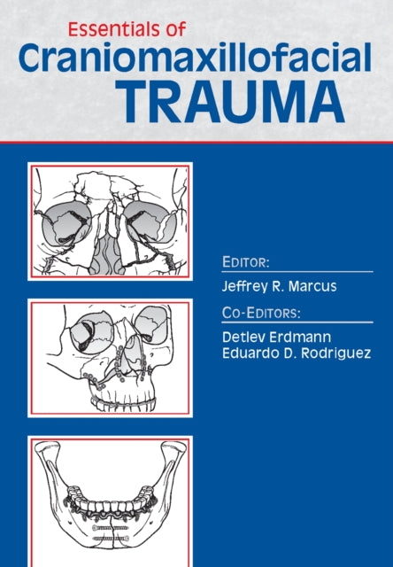 Book cover of: Essentials of Craniomaxillofacial Trauma. By: Jeffrey Marcus