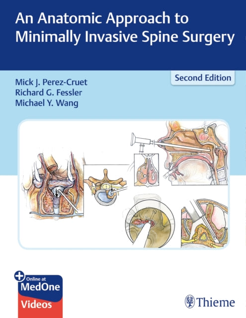 Book cover of: Anatomic Approach to Minimally Invasive Spine Surgery. By: Mick J. Perez-Cruet