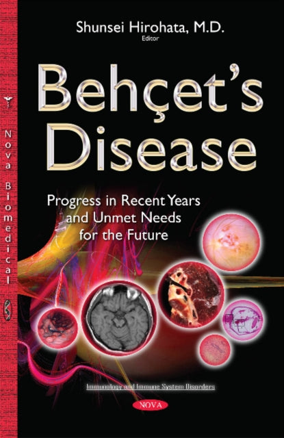 Book cover of: Behcets Disease. By: Shunsei Hirohata