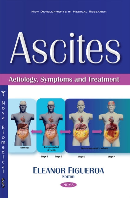 Book cover of: Ascites. By: Eleanor Figueroa