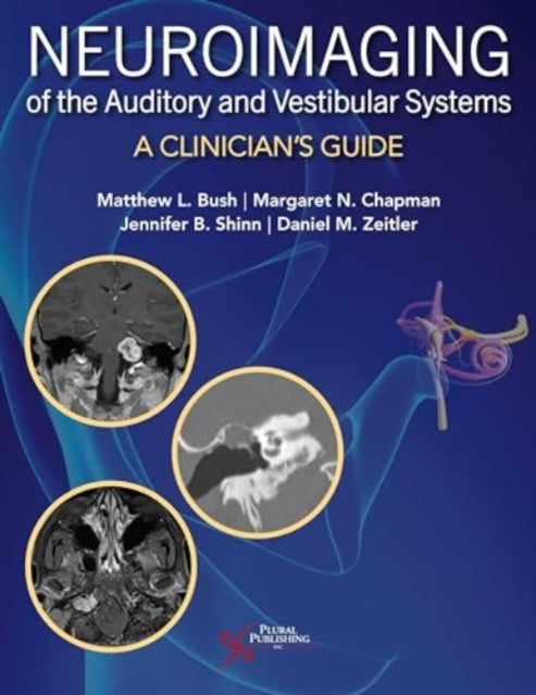 Book cover of: Neuroimaging of the Auditory and Vestibular Systems. By: Matthew Bush