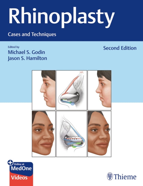 Book cover of: Rhinoplasty. By: Michael S. Godin