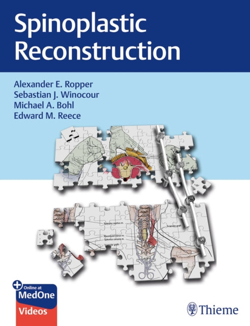 Book cover of: Spinoplastic Reconstruction. By: Alexander Ropper
