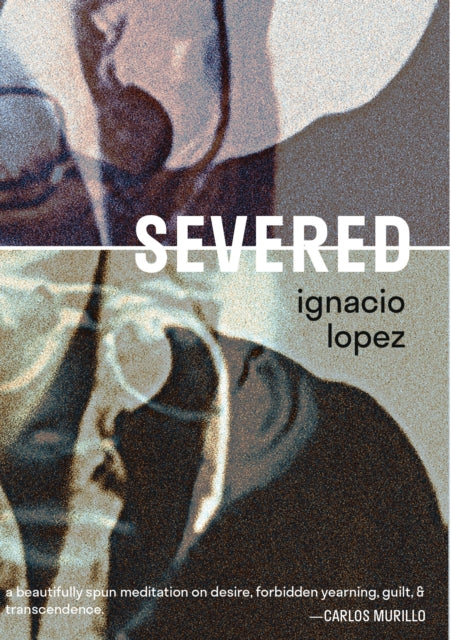 Book cover of: Severed. By: Ignacio Lopez