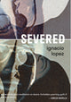Book cover of: Severed. By: Ignacio Lopez