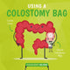 Book cover of: Wearing a Colostomy Bag. By: Harriet Brundle