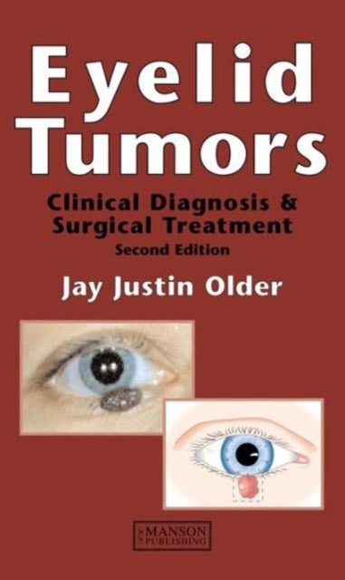Book cover of: Eyelid Tumors