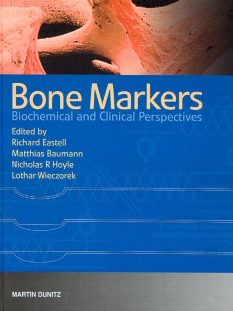 Book cover of: Bone Markers. By: Richard Eastell