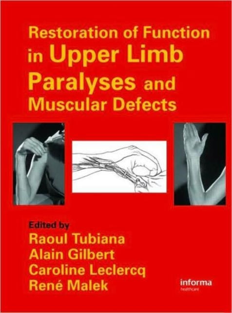 Book cover of: Restoration of Function in Upper Limb Paralyses and Muscular Defects
