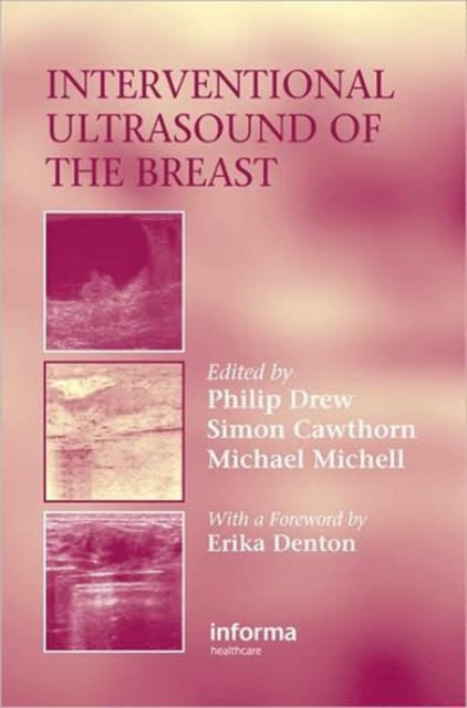 Book cover of: Interventional Ultrasound of the Breast