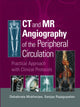 Book cover of: CT and MR Angiography of the Peripheral Circulation