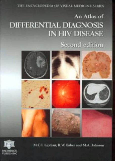 Book cover of: Atlas of Differential Diagnosis in HIV Disease