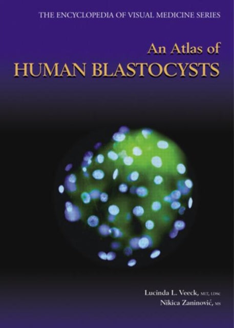 Book cover of: Atlas of Human Blastocysts. By: Lucinda L. Veeck