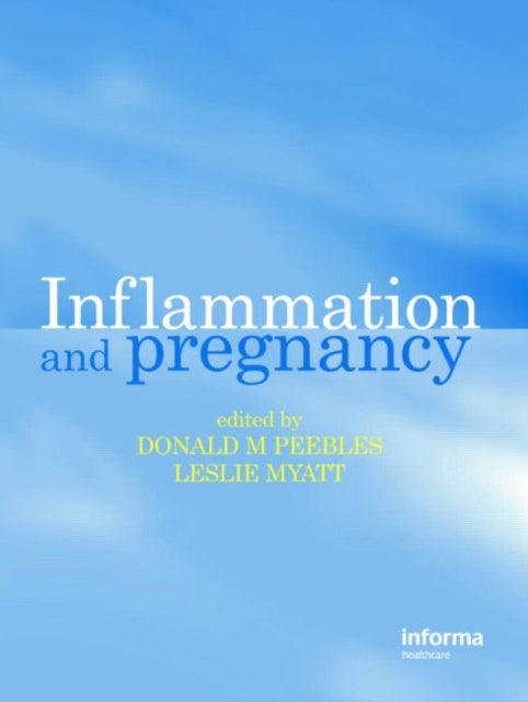 Book cover of: Inflammation and Pregnancy