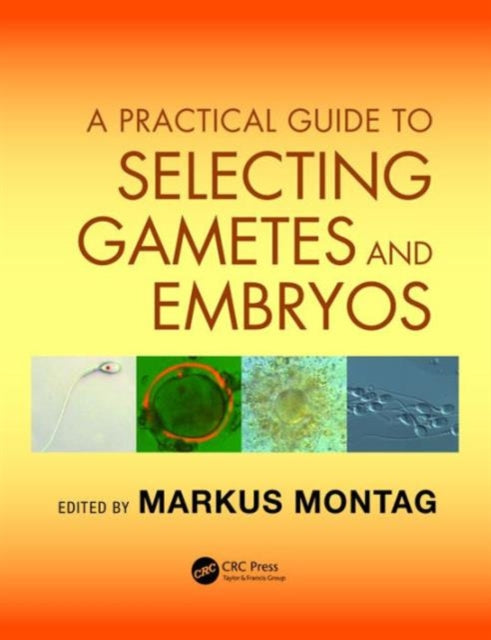 Book cover of: Practical Guide to Selecting Gametes and Embryos. By: Markus Montag