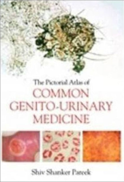 Book cover of: Pictorial Atlas of Common Genito-Urinary Medicine. By: Shiv Shanker Pareek