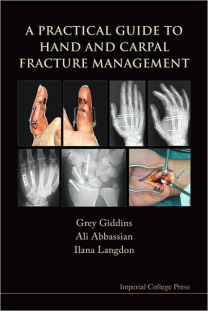 Book cover of: Practical Guide To Hand And Carpal Fracture Management, A. By: Grey Giddins