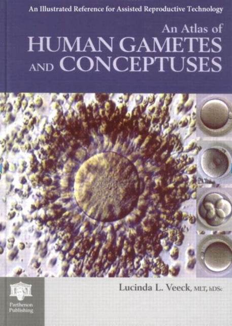 Book cover of: Atlas of Human Gametes and Conceptuses