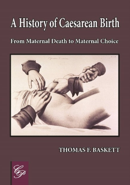 Book cover of: History of Caesarean Birth