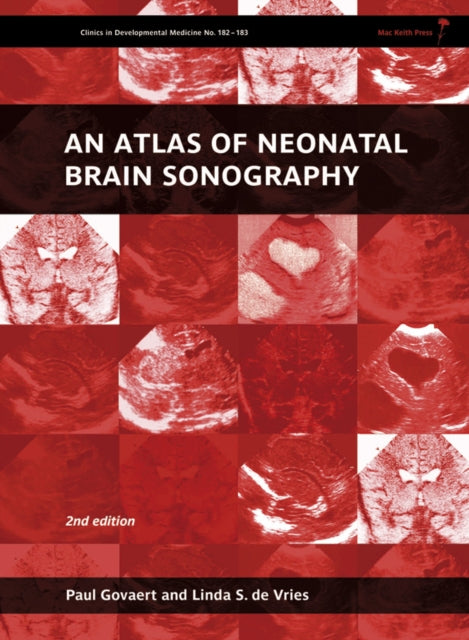 Book cover of: Atlas of Neonatal Brain Sonography. By: Paul Govaert