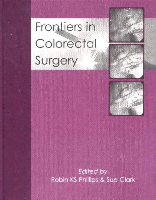 Book cover of: Frontiers in Colorectal Surgery. By: Sue Clark
