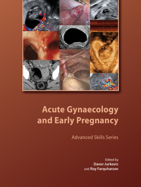 Book cover of: Acute Gynaecology and Early Pregnancy. By: Davor Jurkovic