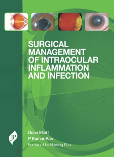 Book cover of: Surgical Management of Intraocular Inflammation and Infection
