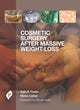 Book cover of: Cosmetic Surgery after Massive Weight Loss