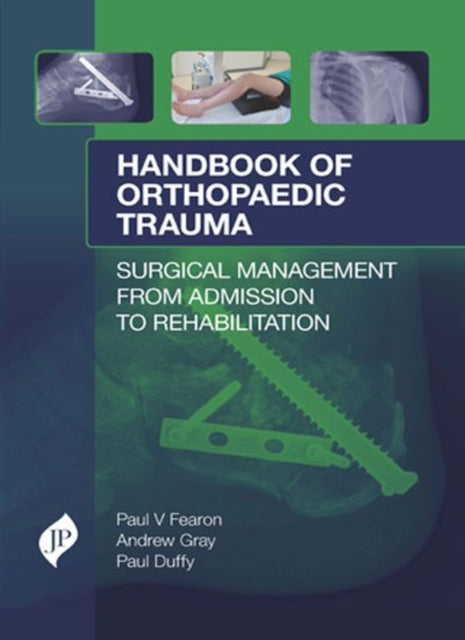 Book cover of: Handbook of Orthopaedic Trauma. By: Paul V. Fearon