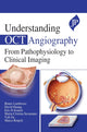 Book cover of: Understanding OCT Angiography. By: Bruno Lumbroso