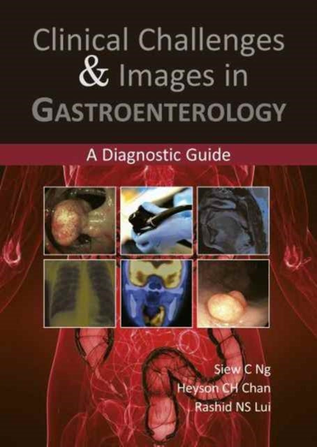 Book cover of: Clinical Challenges & Images in Gastroenterology. By: Siew C. Ng