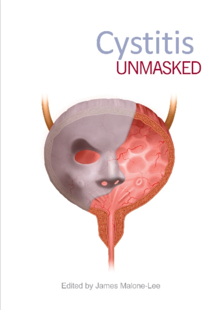 Book cover of: Cystitis Unmasked. By: James Malone-Lee