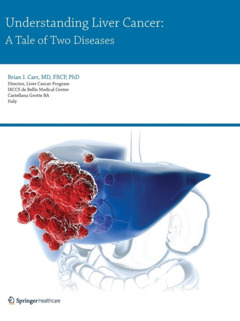 Book cover of: Understanding Liver Cancer. By: Brian I. I. Carr