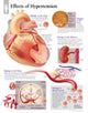 Book cover of: Effects of Hypertension Paper Poster. By: Scientific Publishing