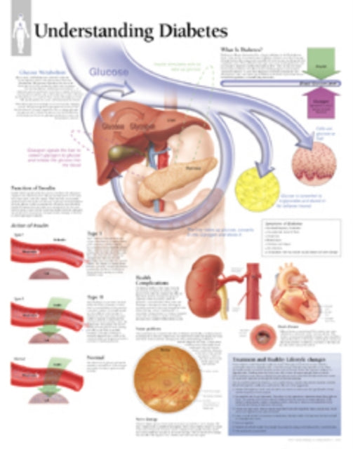 Book cover of: Understanding Diabetes Paper Poster. By: Scientific Publishing