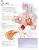 Book cover of: COPD (Chronic Obstructive Pulmonary Disease) Paper Poster. By: Scientific Publishing