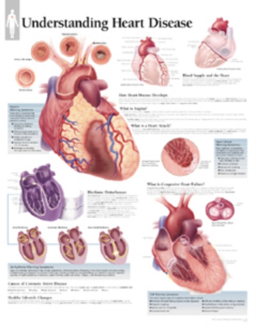 Book cover of: Understanding Heart Disease Paper Poster. By: Scientific Publishing